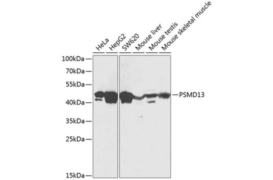 Western Blot - Anti-PSMD13 Antibody (A89957) - Antibodies.com