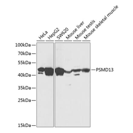 Western Blot - Anti-PSMD13 Antibody (A89957) - Antibodies.com