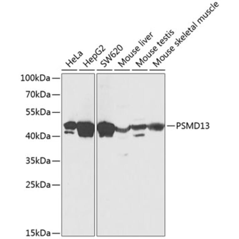 Western Blot - Anti-PSMD13 Antibody (A89957) - Antibodies.com