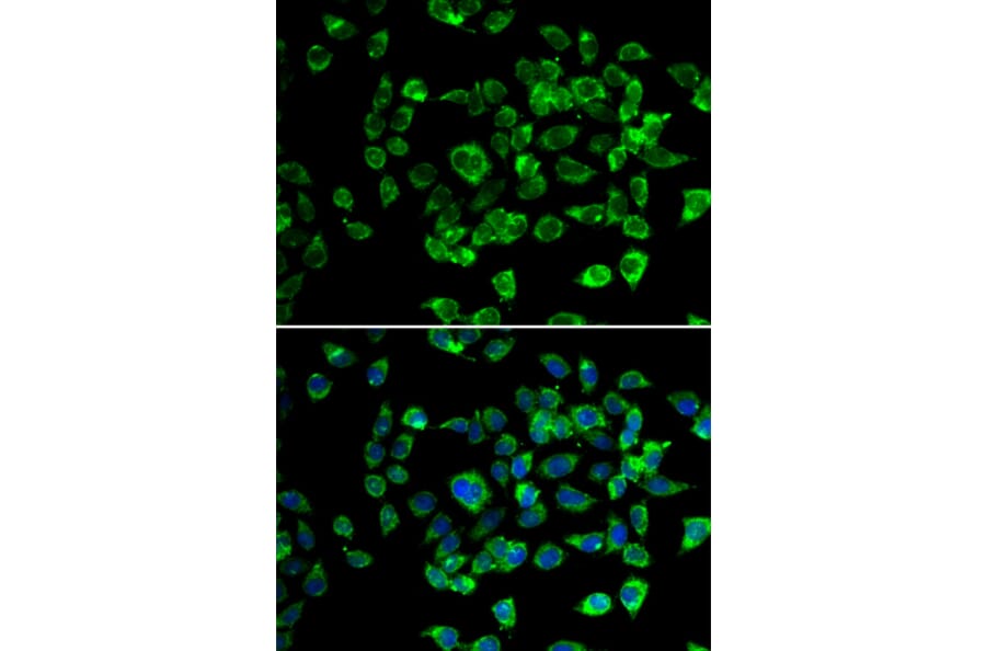 Immunofluorescence - Anti-PSMD13 Antibody (A89957) - Antibodies.com