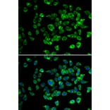 Immunofluorescence - Anti-PSMD13 Antibody (A89957) - Antibodies.com