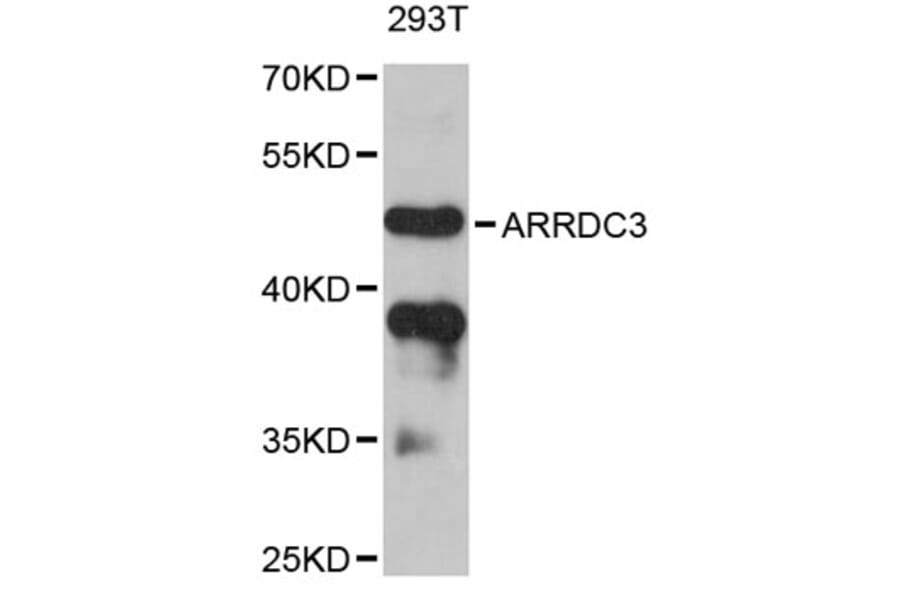 Western Blot - Anti-ARRDC3 Antibody (A12262) - Antibodies.com