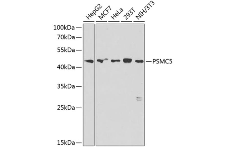 Western Blot - Anti-PSMC5 Antibody (A89959) - Antibodies.com