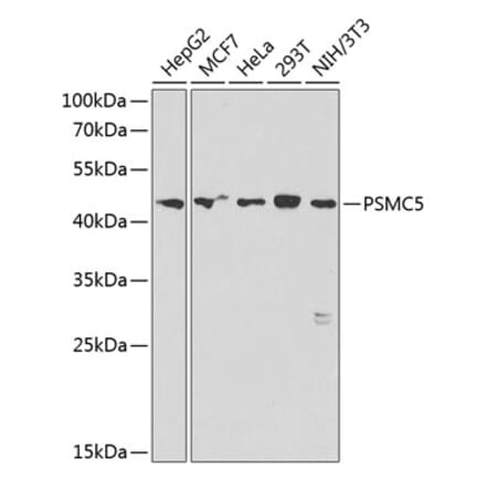 Western Blot - Anti-PSMC5 Antibody (A89959) - Antibodies.com