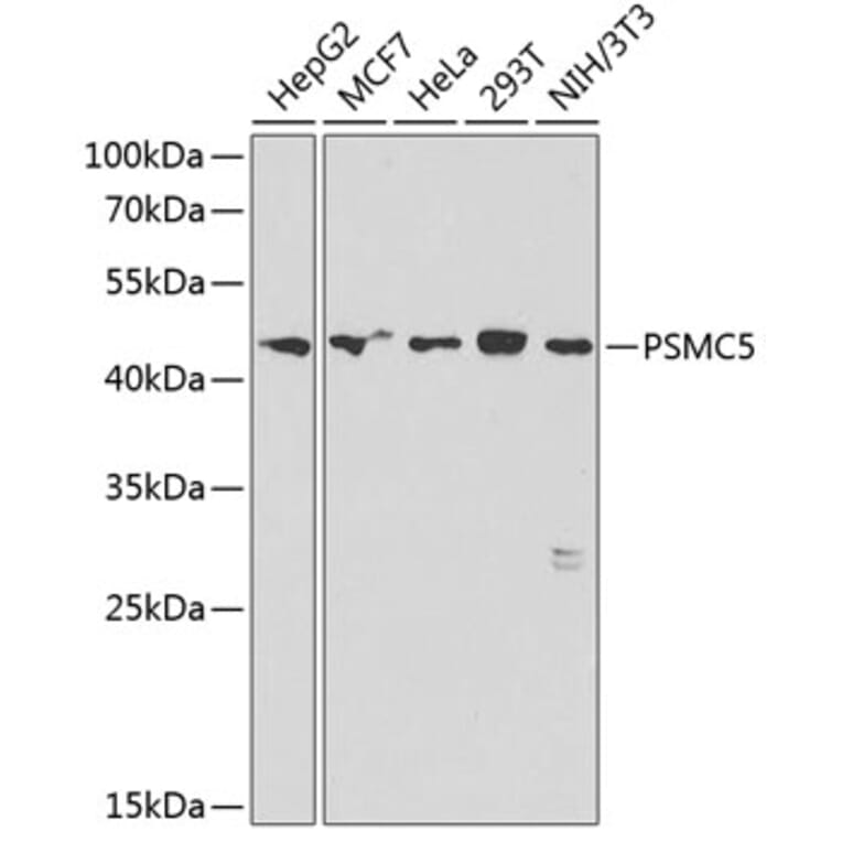 Western Blot - Anti-PSMC5 Antibody (A89959) - Antibodies.com