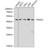 Western Blot - Anti-PSMC5 Antibody (A89959) - Antibodies.com