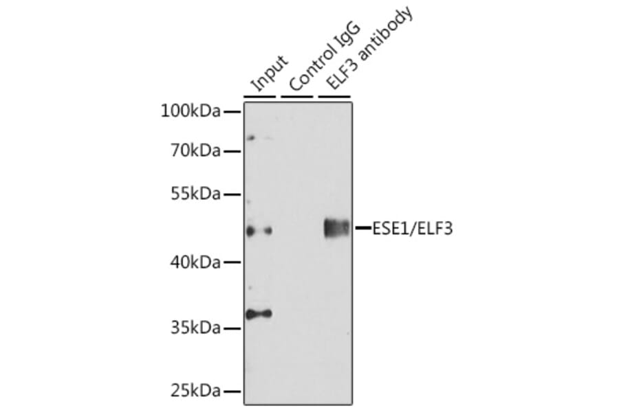 Western Blot - Anti-ESE1 Antibody (A89960) - Antibodies.com