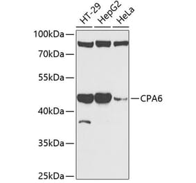 Western Blot - Anti-CPA6 Antibody (A89961) - Antibodies.com