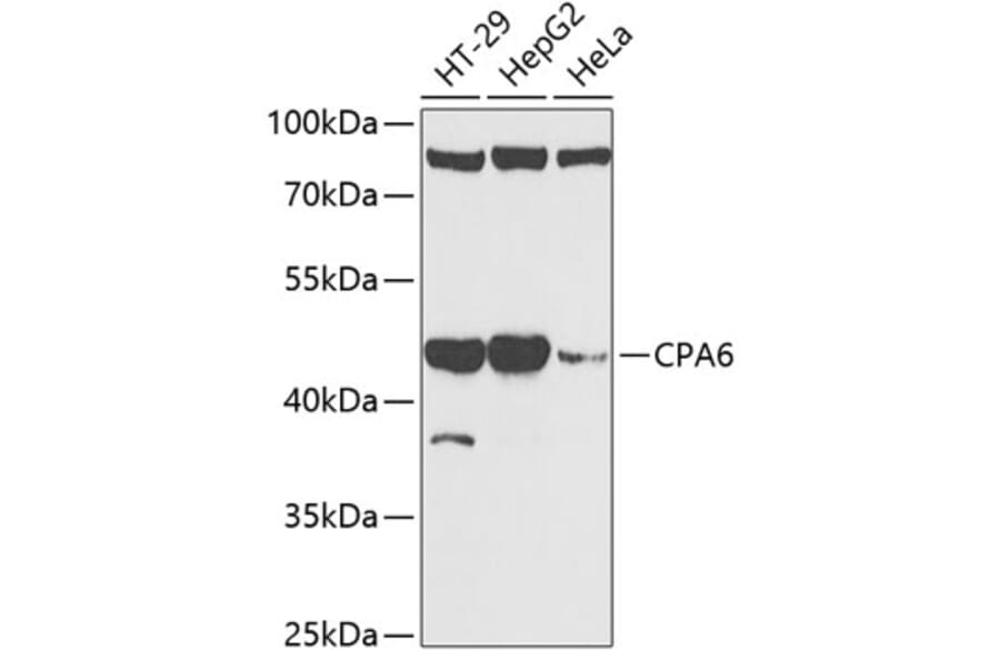 Western Blot - Anti-CPA6 Antibody (A89961) - Antibodies.com