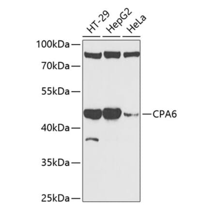 Western Blot - Anti-CPA6 Antibody (A89961) - Antibodies.com