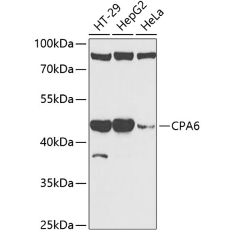 Western Blot - Anti-CPA6 Antibody (A89961) - Antibodies.com