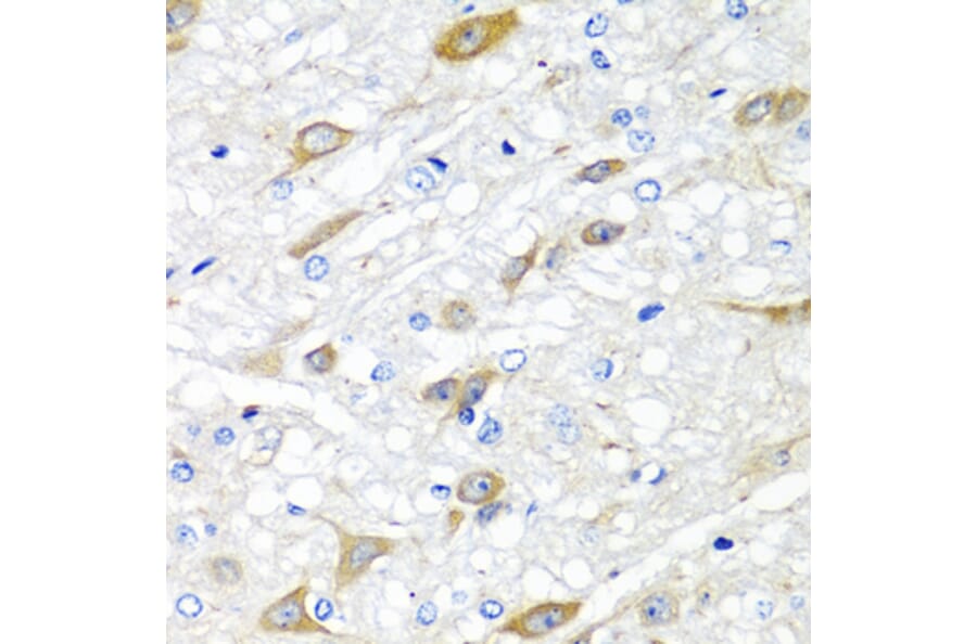 Immunohistochemistry - Anti-CPA6 Antibody (A89961) - Antibodies.com