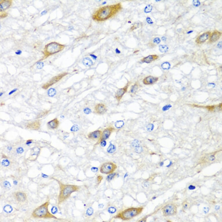 Immunohistochemistry - Anti-CPA6 Antibody (A89961) - Antibodies.com