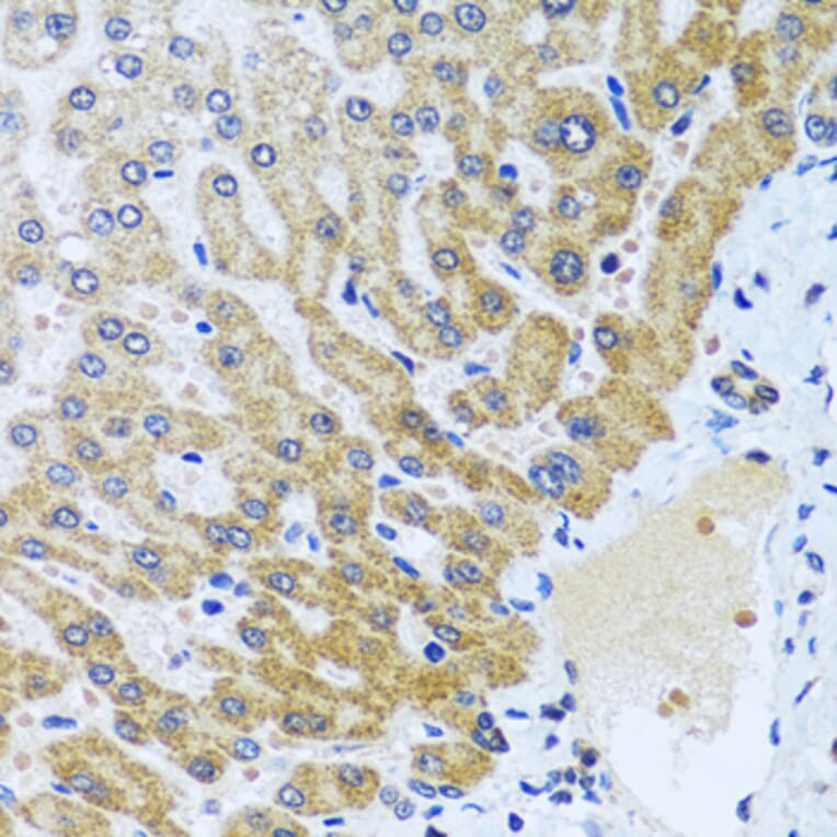 Immunohistochemistry - Anti-CPA6 Antibody (A89961) - Antibodies.com