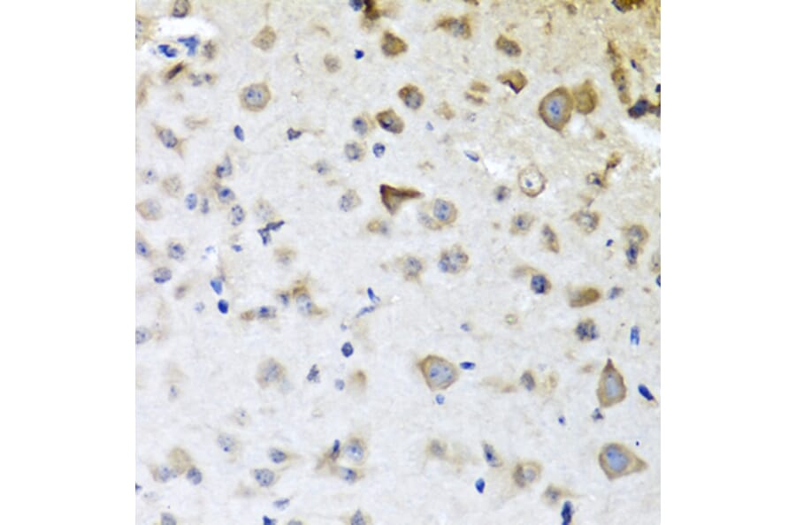 Immunohistochemistry - Anti-CPA6 Antibody (A89961) - Antibodies.com