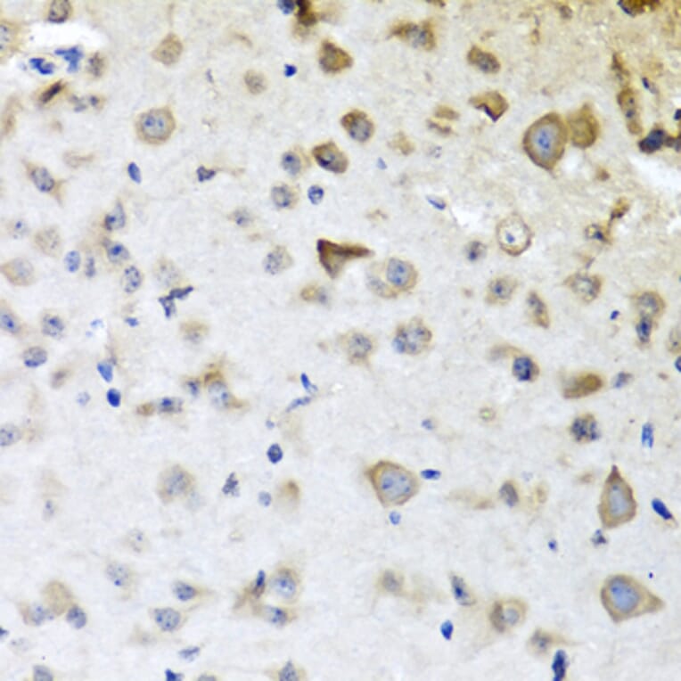 Immunohistochemistry - Anti-CPA6 Antibody (A89961) - Antibodies.com