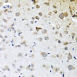 Immunohistochemistry - Anti-CPA6 Antibody (A89961) - Antibodies.com