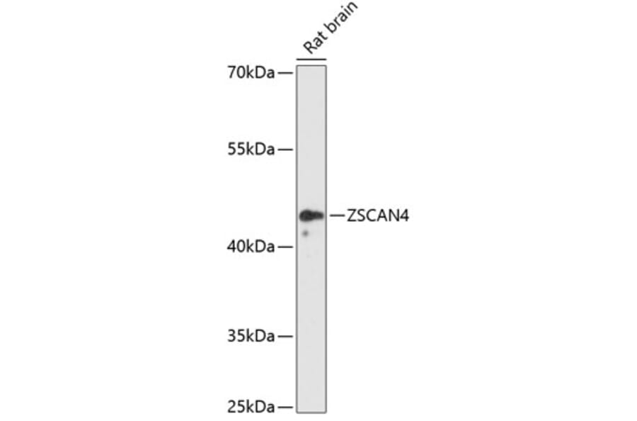 Western Blot - Anti-ZSCAN4 Antibody (A89963) - Antibodies.com
