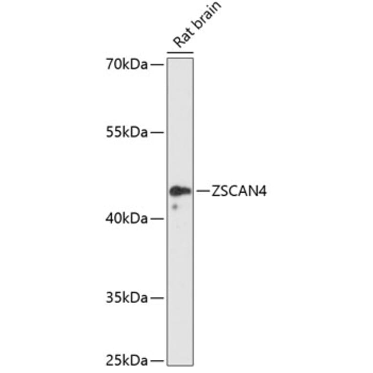 Western Blot - Anti-ZSCAN4 Antibody (A89963) - Antibodies.com