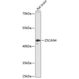 Western Blot - Anti-ZSCAN4 Antibody (A89963) - Antibodies.com