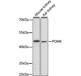 Western Blot - Anti-POMK Antibody (A89964) - Antibodies.com
