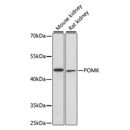 Western Blot - Anti-POMK Antibody (A89964) - Antibodies.com
