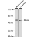Western Blot - Anti-POMK Antibody (A89964) - Antibodies.com
