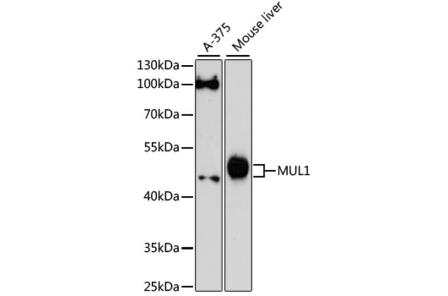 Western Blot - Anti-E3 ubiquitin-protein ligase MUL1 Antibody (A89966) - Antibodies.com