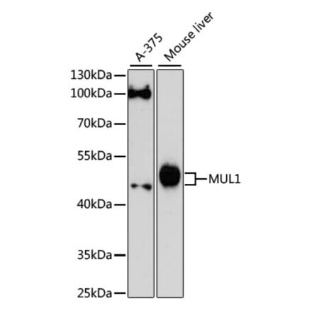 Western Blot - Anti-E3 ubiquitin-protein ligase MUL1 Antibody (A89966) - Antibodies.com