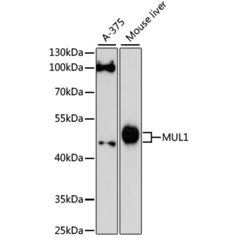 Western Blot - Anti-E3 ubiquitin-protein ligase MUL1 Antibody (A89966) - Antibodies.com