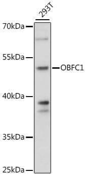 Western blot analysis of extracts of 293T cells, using Anti-OBFC1 Antibody (A16146) at 1:1,000 dilution.
Secondary antibody: Goat Anti-Rabbit IgG (H+L) (HRP) (AS014) at 1:10,000 dilution.
Lysates / proteins: 25µg per lane.
Blocking buffer: 3% non-fat dry milk in TBST.
Detection: ECL Basic Kit (RM00020).
Exposure time: 60s.