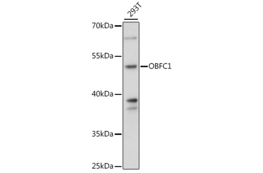 Western Blot - Anti-OBFC1 Antibody (A89967) - Antibodies.com