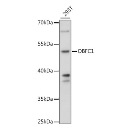 Western Blot - Anti-OBFC1 Antibody (A89967) - Antibodies.com
