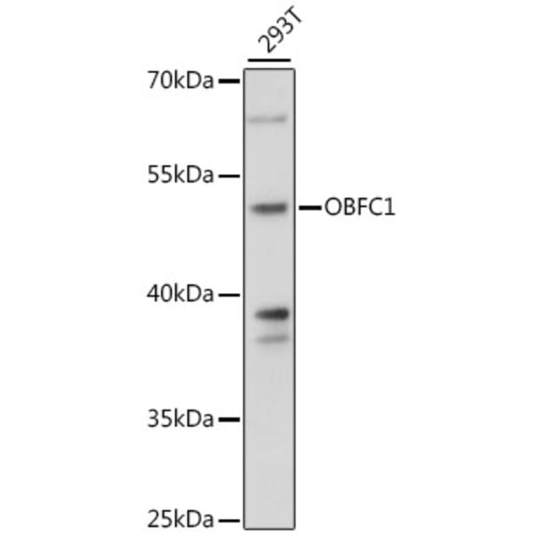 Western Blot - Anti-OBFC1 Antibody (A89967) - Antibodies.com