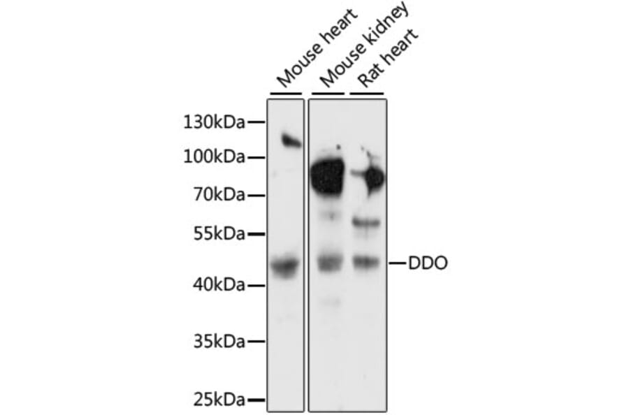Western Blot - Anti-DDO Antibody (A89968) - Antibodies.com