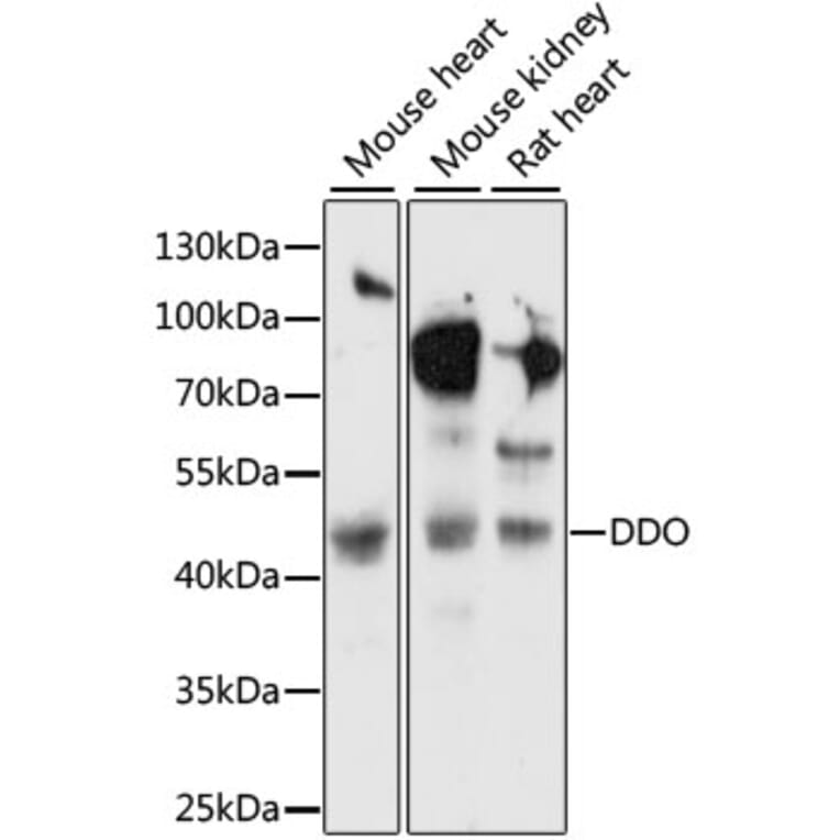 Western Blot - Anti-DDO Antibody (A89968) - Antibodies.com