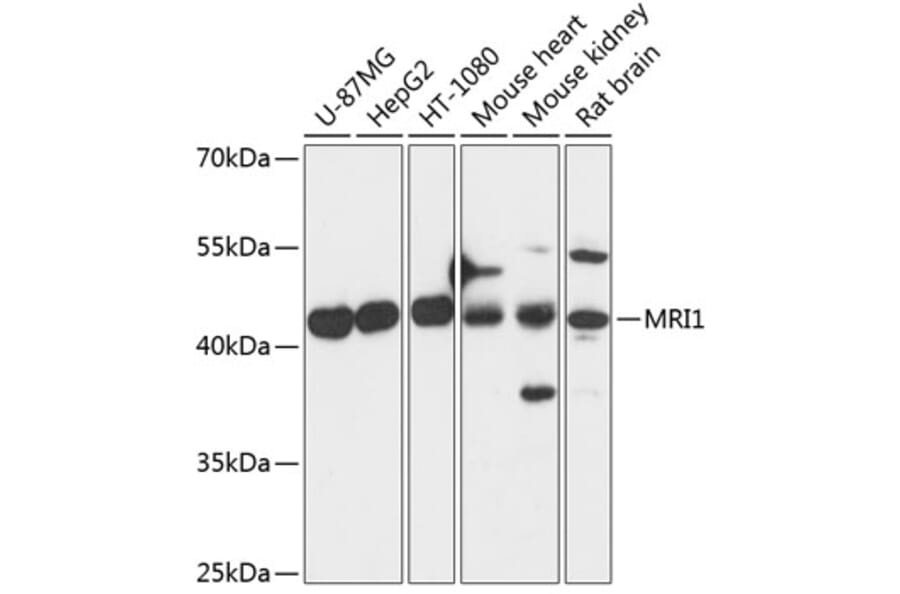 Western Blot - Anti-EI2BL Antibody (A89969) - Antibodies.com