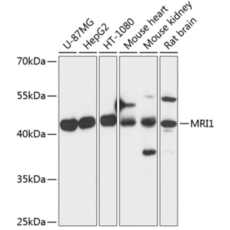 Western Blot - Anti-EI2BL Antibody (A89969) - Antibodies.com