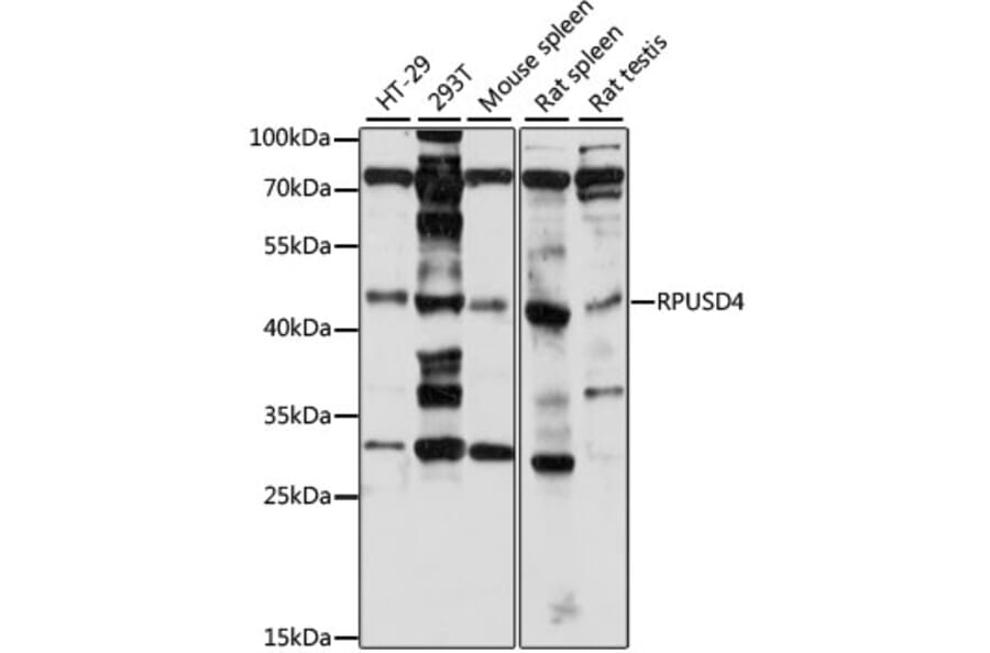 Western Blot - Anti-RPUSD4 Antibody (A89970) - Antibodies.com