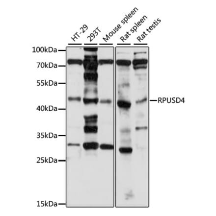 Western Blot - Anti-RPUSD4 Antibody (A89970) - Antibodies.com