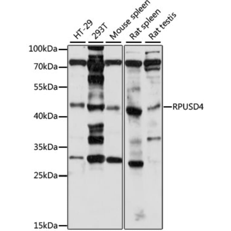 Western Blot - Anti-RPUSD4 Antibody (A89970) - Antibodies.com
