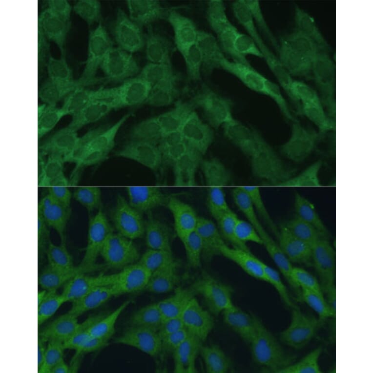 Immunofluorescence - Anti-IDH1 Antibody (A89971) - Antibodies.com
