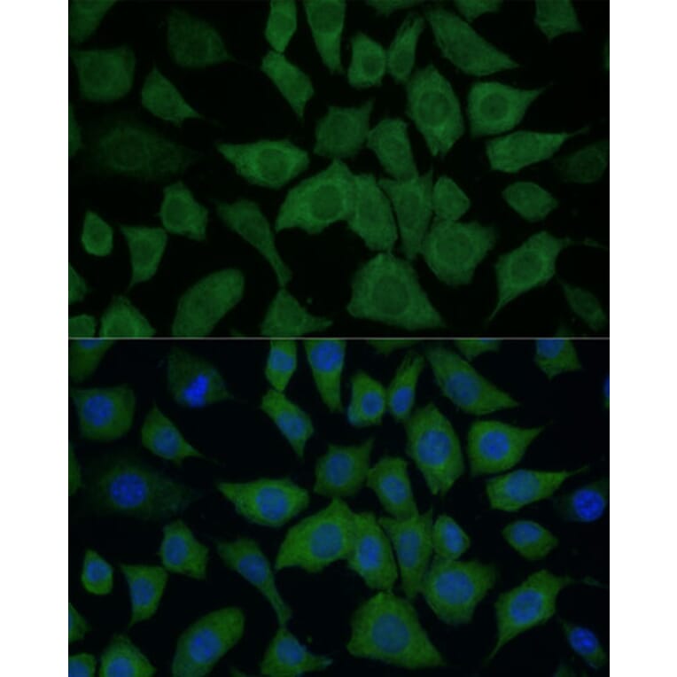 Immunofluorescence - Anti-IDH1 Antibody (A89971) - Antibodies.com