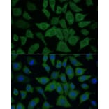 Immunofluorescence - Anti-IDH1 Antibody (A89971) - Antibodies.com