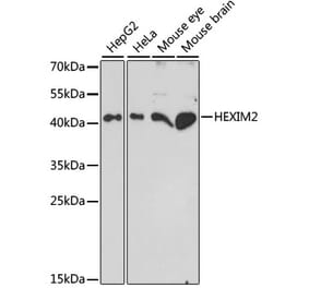 Western Blot - Anti-HEXIM2 Antibody (A89972) - Antibodies.com