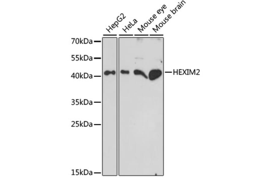 Western Blot - Anti-HEXIM2 Antibody (A89972) - Antibodies.com