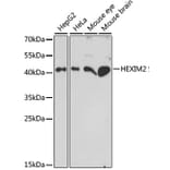 Western Blot - Anti-HEXIM2 Antibody (A89972) - Antibodies.com