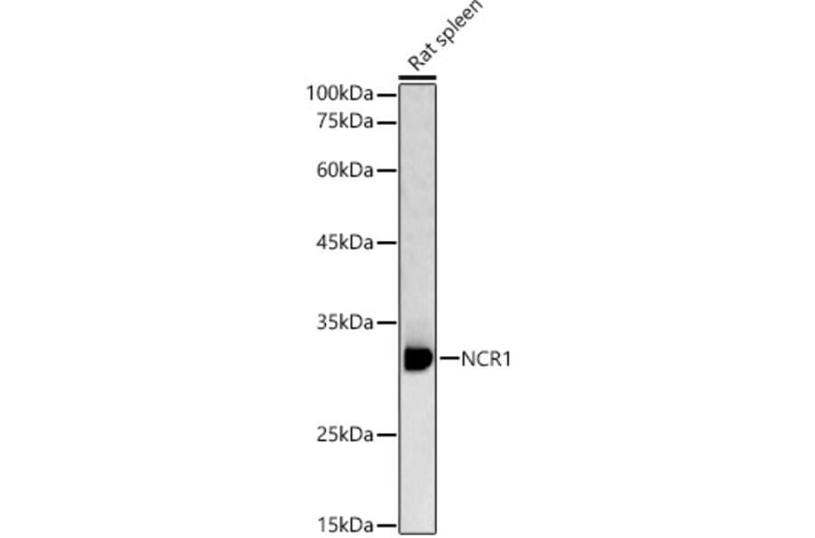 Western Blot - Anti-NCR1 Antibody (A89973) - Antibodies.com