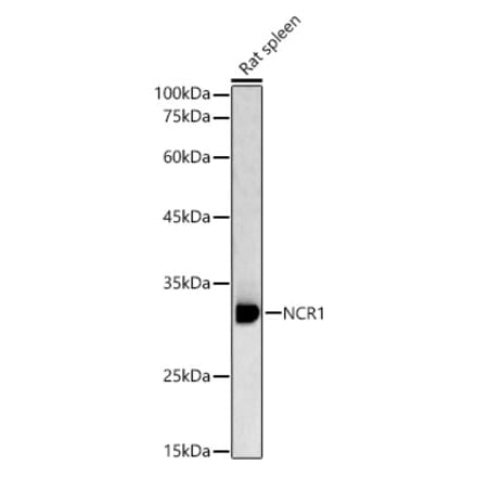 Western Blot - Anti-NCR1 Antibody (A89973) - Antibodies.com
