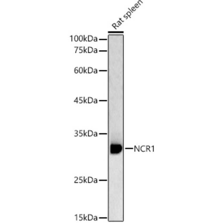 Western Blot - Anti-NCR1 Antibody (A89973) - Antibodies.com